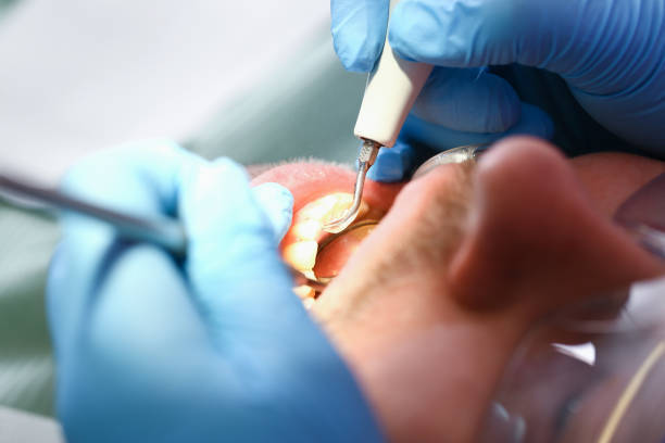 Best Broken or Chipped Tooth Repair in Sharpsville, PA